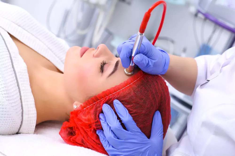 Practising Advanced Techniques Radiofrequency Microneedling and PRP